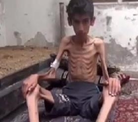 سازمان ملل در نجات مردم سوريه شكست خورده است