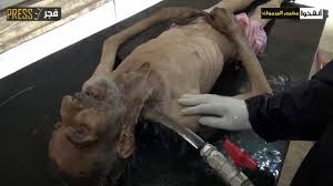 فاجعه انساني در سوريه