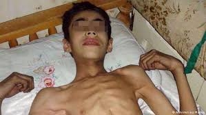 جان دادن نوجوان ۱۶ساله سوري از گرسنگی جلوي چشم" افراد اين سازمان يونيسف