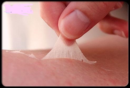 کشف جدید :درمان عارضه‌های ناشی از سوختگی