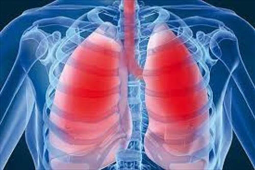 ذات الریه چیست ؟چگونه درمان می شود؟