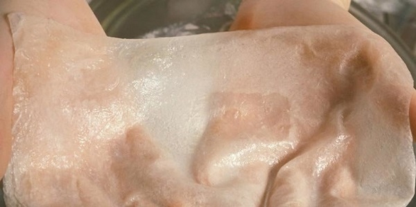 نجات برادر دوقلو  با هديه پوست