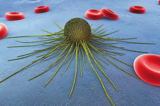 امیدی تازه برای تشخیص سرطان