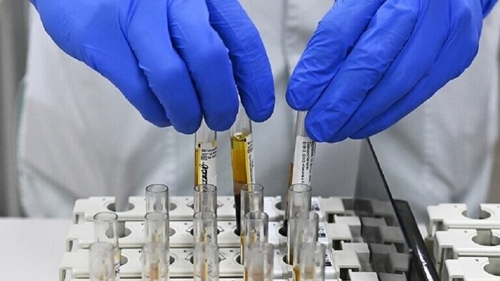 سازمان جهانی بهداشت : فرضیه نشت ویروس کرونا از آزمایشگاهی در چین ـ ۱۴ کشور جهان خواستار تحقیقات بیشتر