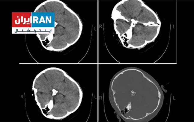 Schalchthof von iranischen Frauen