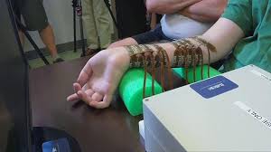 امید برای بازیابی تحرک اندام فلج