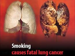 روي پاكت سيگار چه بايد نوشت؟