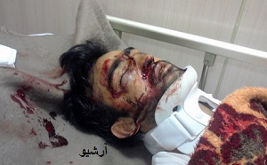 شهروند سيريکي تير خورده توسط ماموران درياباني، به علت شدت جراحات بشهادت رسيد