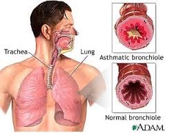 شناخت بدن و بیماری های آن ـ قسمت هفتم ـآسم چه علائم و دردی ایجاد می کند؟