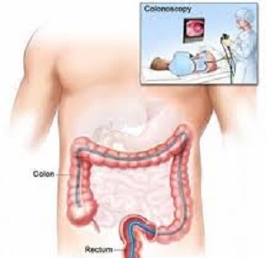 شناخت بدن و بیماری های آن ـ قسمت هشتم ـ روده را با ملایمت فعا ل کردن