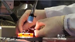 نانوميله ها به جنگ سلولهاي سرطاني مي روند