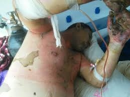 آخرين وضعيت يونس عساكره در بيمارستان