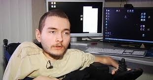 پیوند سر فردی فلج به مردی که ضربه مغزی شده است