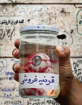 مشهد : گزارشي هولناك از فروش قرنيه چشم