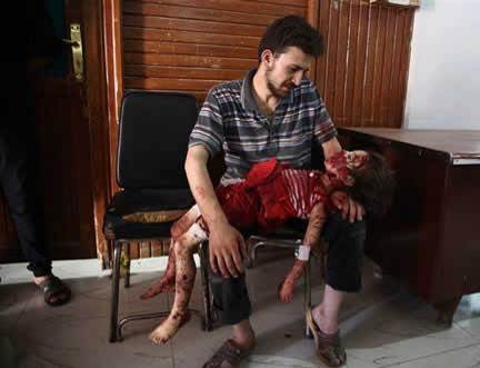 دوما، زخمي که درمان نمي‌شود